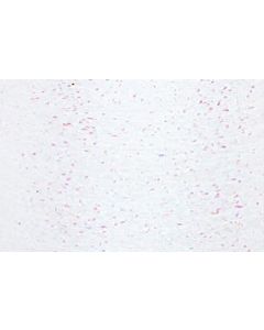 Madeira 300 - Supertwist mt. 200